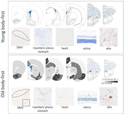 Impact of aging on animal models of Parkinson's disease